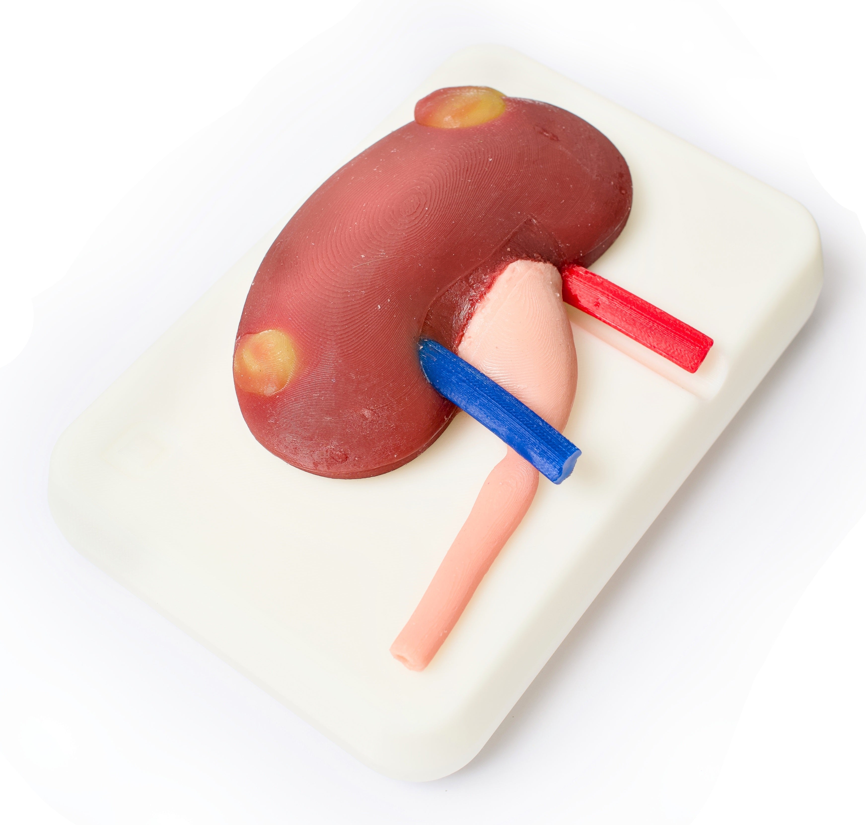 Kidney