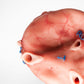 Complex Bladder