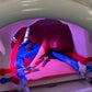 Kidney Transplant Model (RAKT / Laparoscopic / Open)