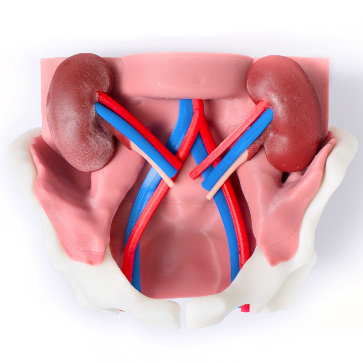 Kidney Transplant Model (RAKT / Laparoscopic / Open)
