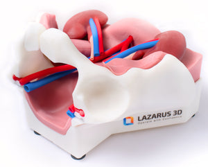 Kidney Transplant Model (RAKT / Laparoscopic / Open)