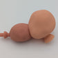 Simple Prostatectomy