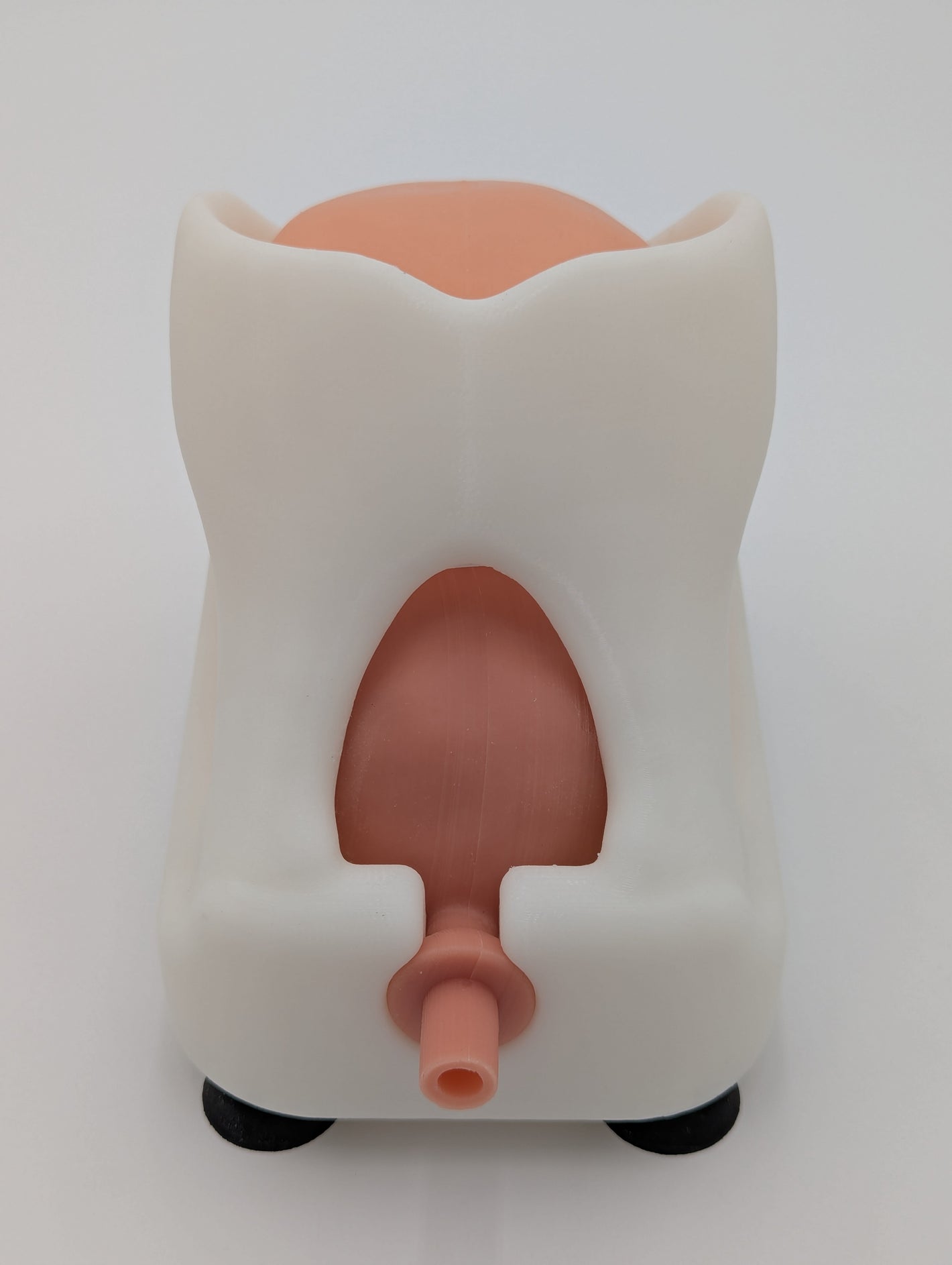 Simple Prostatectomy